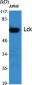 Lck Polyclonal Antibody